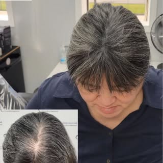 SMP Density treatments are a little different from the bald guys. Density treatments use much darker