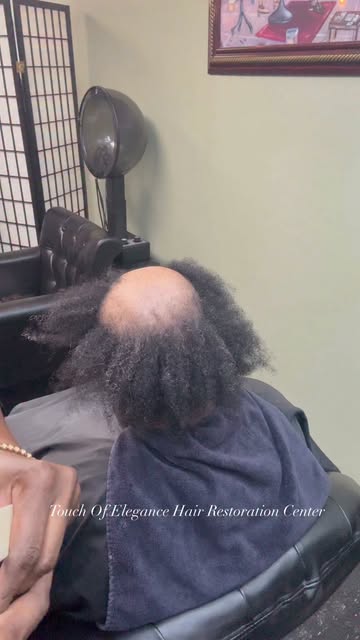 Hair restoration isn’t only about encouraging new growth. It’s also about protecting and strengtheni