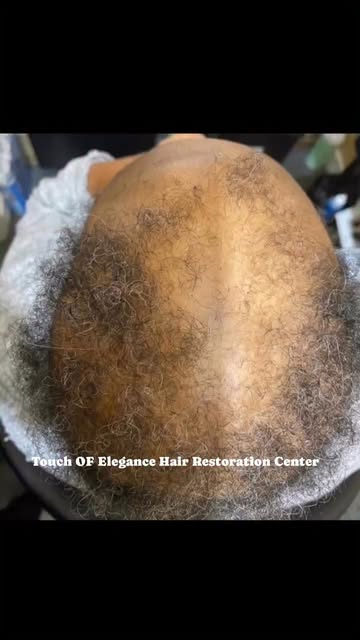 WHAT IF SHE HAD GIVEN UP?

Five years ago, we started with one goal: to fight for her hair.

No over