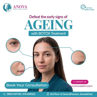 Botox is useful for many indiciations from wrinkles to texture, pores & glow.