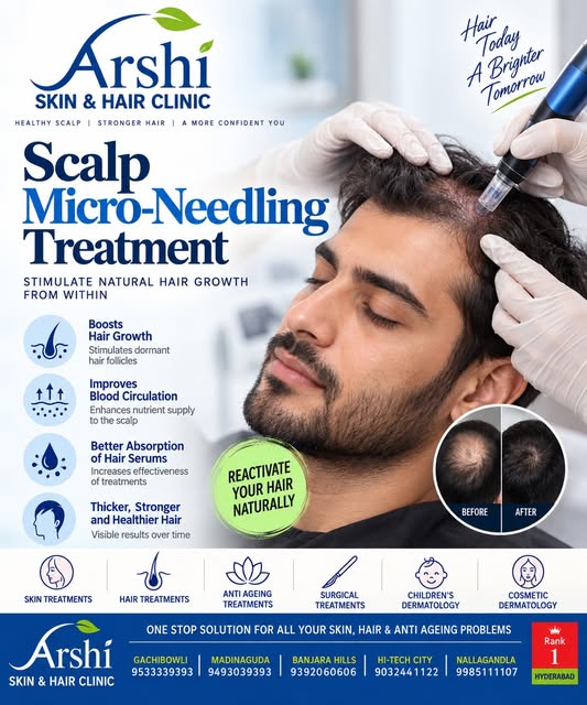 💙 Stimulate. Strengthen. Support Hair Growth.

Scalp microneedling is a hair treatment designed to 
