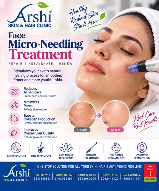 ✨ Repair. Rejuvenate. Renew.

Microneedling can be used as part of a dermatological approach to impr
