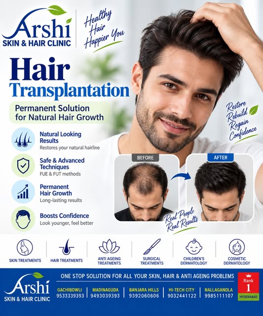 💙 Restore. Rebuild. Regain Confidence.

Hair transplantation can provide a long-term solution for s