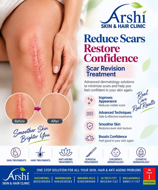 ✨ Reduce Scars. Restore Confidence.

Scars can affect both skin texture and confidence.

Scar revisi