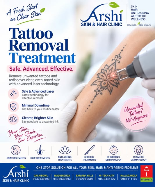 ✨ A Fresh Start on Clearer Skin.

Thinking about removing an unwanted tattoo?

Advanced laser-based 