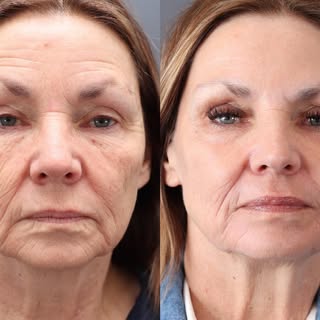 Just a repost of a previous case to better allow you to see the amazing results we can get you with 