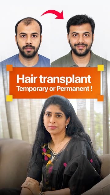 Hair Transplant = Temporary or Permanent? 🤔🌱

Thinking a hair transplant gives you a lifetime guar