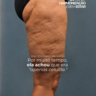 Tem mulheres que passam anos tentando resolver o que acreditam ser apenas uma questão estética e, ne