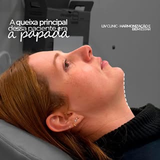 Nem sempre a queixa principal é a única que precisa ser tratada. ✨

Um planejamento individualizado 