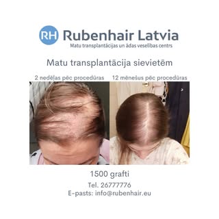 Iespaidīgs un dabīgs rezultāts 🤩

✉ info@rubenhair.eu
🌎 www.rubenhair.eu
☎️ +371 26777776

#hair #