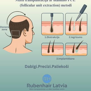 🟢 Dabīgi. Precīzi. Paliekoši. Atjauno matu līniju un biezumu vienā dienā ar pasaules modernāko matu