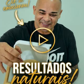 Micropigmentação capilar com resultado natural para quem busca uma solução discreta para a calvície.