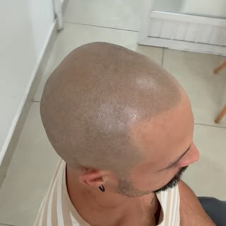 Esse é apenas um dos resultados do Natural+
Analisamos, planejamos o resultado harmônico baseado no 