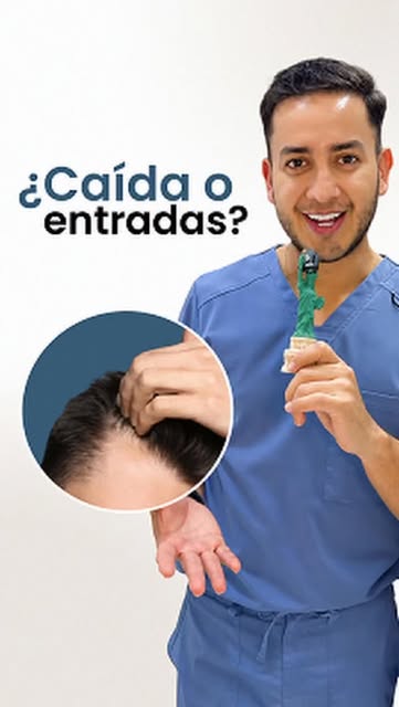 ¿Todavía dices que “solo tienes la frente amplia”? 👀

Muchas personas normalizan las entradas o la 