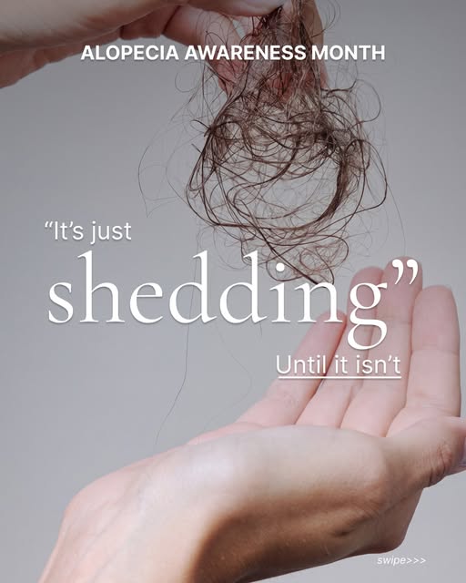 September is Alopecia Awareness Month.
Hair loss can happen for many different reasons, and understa