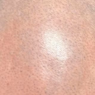 Hair loss doesn’t have to define you.

Scalp Micropigmentation (SMP) creates the look of real hair f