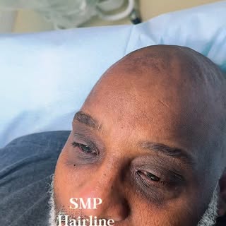 Clean Hairline. Real Confidence. 💈

Struggling with receding hairlines, thinning edges, or bald spo