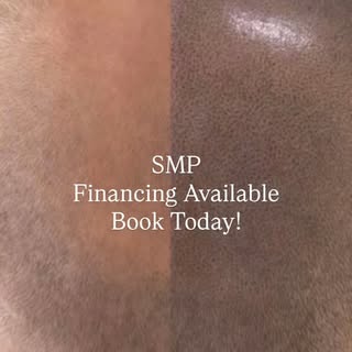 🚨 THINNING HAIR? BALD SPOTS? RECEDING HAIRLINE? 🚨
It’s time to bring your confidence back with Sca