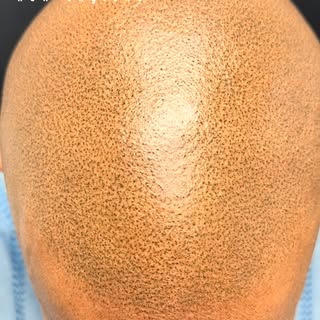 Scalp New England | 13+ years of trusted care, proven results, helping clients across New England re