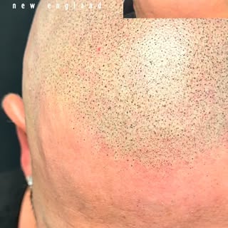 Scalp New England | 13+ years of trusted care, proven results, helping clients across New England re