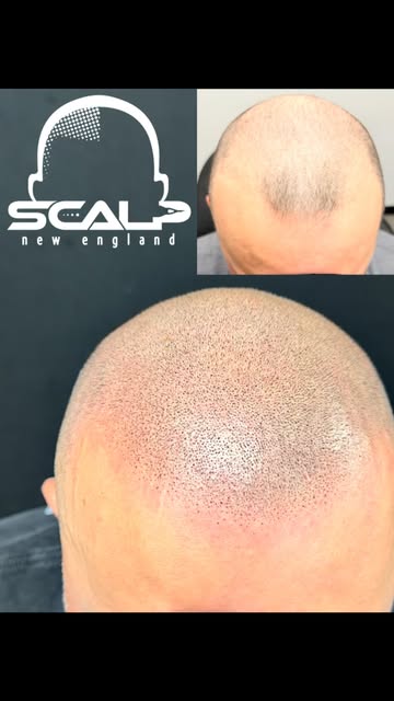 Nice transformation for this client. Book your free consult and see what we can do for you. #hairtat