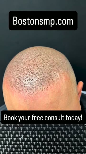 Book your free consult today, and let us help give you a transformation that will last a lifetime. #