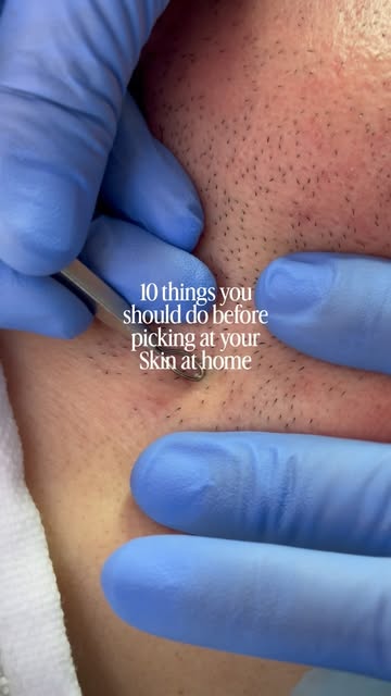 10 things to do before picking your own skin at home…. 

1. Book with us 

We’ll handle the other 9 