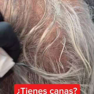 👨‍🦳👩‍🦳 ¿Micropigmentación con canas? ¡Es posible y queda espectacular!

¿Pensaste que la micropi