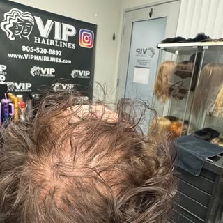 Incredible transformation !! Hair toppers are used to enhance the hair you already have. Need some h