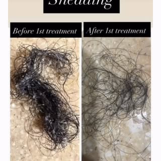 As a Hair coach, these are the results when I helped one of my customers online stop excessive shedd