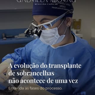 Fazer um transplante de sobrancelhas é um processo de transformação  e a ansiedade pelo resultado fi
