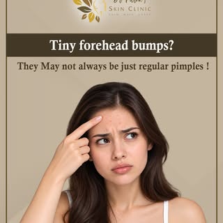Tiny bumps on your forehead? 👀

They may not always be regular pimples!

Those little bumps can som