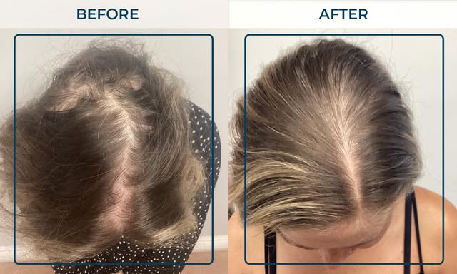 ✨ 8 MONTHS OF PROGRESS — AND A HUGE BOOST IN CONFIDENCE! ✨

Another fantastic result from one of our