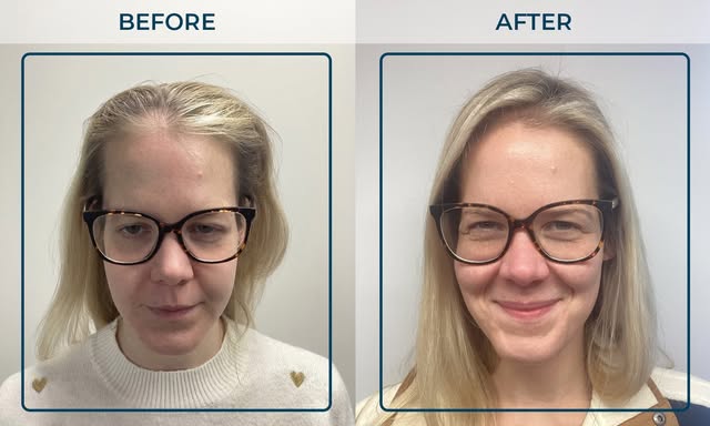 FROM SCEPTICAL… TO TELLING EVERYONE ABOUT IT! 💙

Just look at Maja’s incredible 8-month transformat