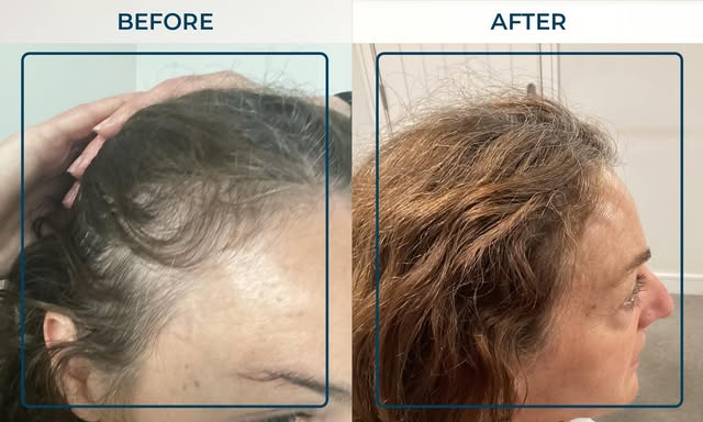 8 MONTHS. WHAT A DIFFERENCE. 💙

Just look at Jackie’s incredible transformation. 👏

When Jackie fi