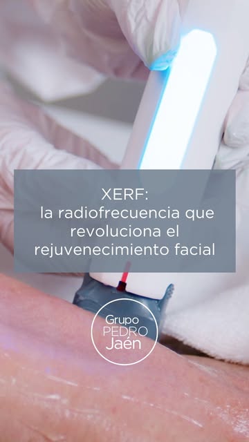 Ya está aquí XERF, la radiofrecuencia que va a revolucionar el rejuvenecimiento facial. Hoy te la pr