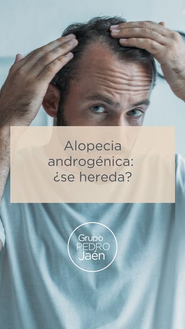 ¿Si mi padre es calvo yo también lo seré? Es la pregunta del millón en las consultas de nuestra Unid