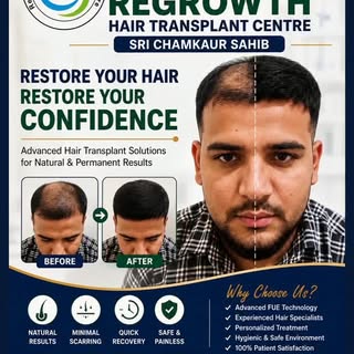 3 months #hair transplant result #hairstylist #nature #cosmetic 7341157666