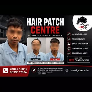 Non-surgical solution | hair fall solution | hair loss solutions | hair wig shop | hair patch guwaha