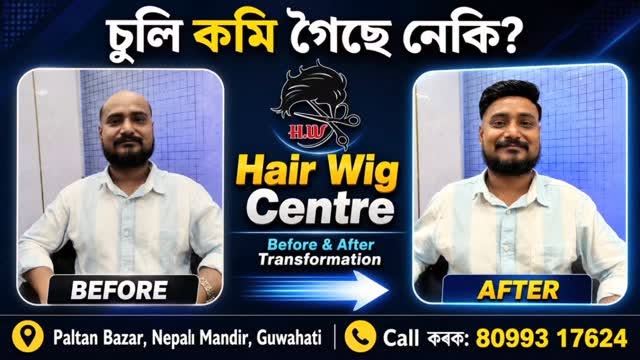 ✨ Regain your confidence with a natural-looking transformation! 💇‍♂️
At Hair Wig Center, we provide