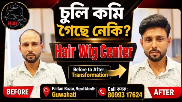 ✨ Natural Look. Confident You. ✨

Looking for a stylish and natural-looking Hair Wig for Men?
Get a 