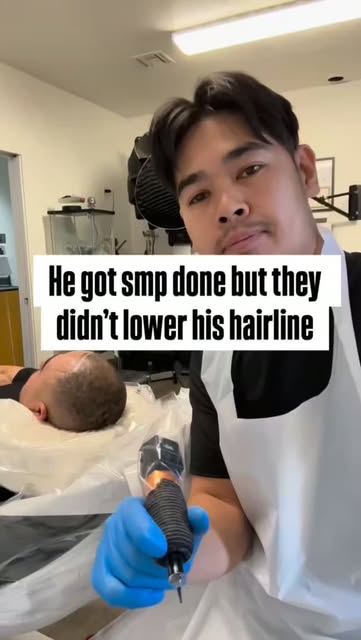 🚨 HE ALREADY HAD SMP… BUT THEY NEVER LOWERED HIS HAIRLINE.

Don’t worry—we can make it look better.