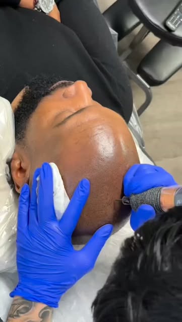 🚨 STOP THINKING ABOUT IT—COME SEE WHAT SMP CAN DO FOR YOU.

Receding hairline? Thinning crown? Scar