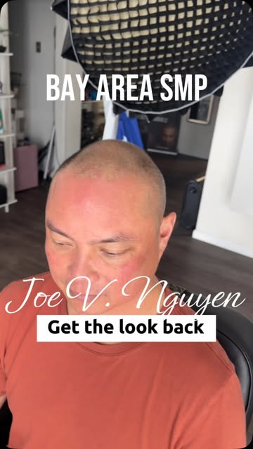 Get the look back with smp by Joe V. Nguyen #bayarea #waitlist #hairlosssolution #scalpmicropigmenta