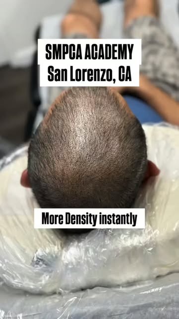 🚨 YOUR HAIR DIDN’T GROW… SO WHY DOES IT LOOK SO MUCH FULLER? 👀

That’s the power of SMP. By reduci
