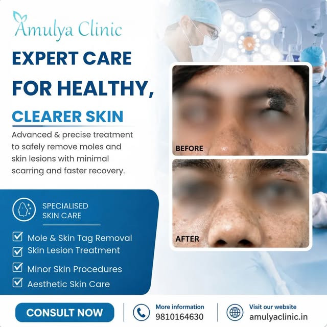 A small procedure can make a noticeable difference. 

Real patient result from Amulya Clinic- showca
