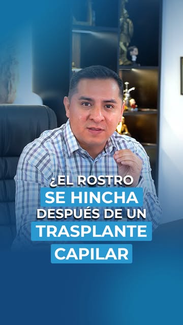 ¿Un rostro completamente hinchado después de un trasplante capilar? 😳

Aunque puede verse alarmante