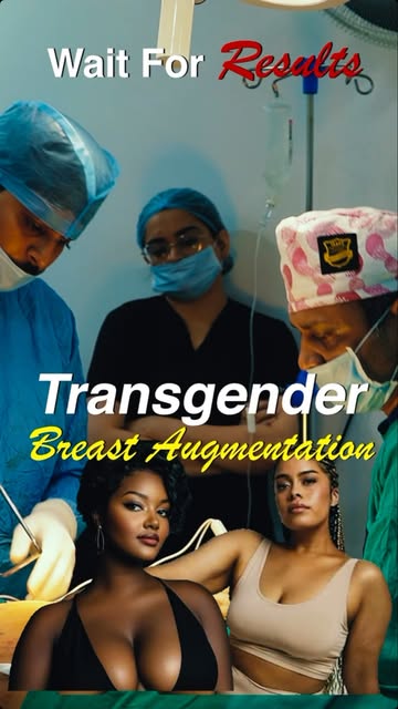 Transgender breast augmentation is more than a cosmetic procedure. It can help align physical appear