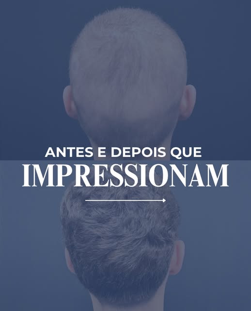 Quando o tratamento é individualizado, a evolução aparece. ✨

Cada caso tem uma história, uma necess