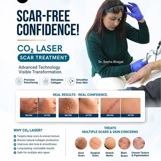 Reveal smoother, renewed-looking skin with CO₂ Laser Scar Treatment.
Target the appearance of acne s
